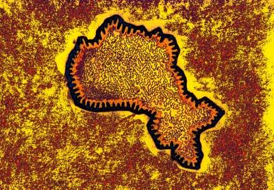 VENONS-EN AUX MAINS ! - ((v.d))