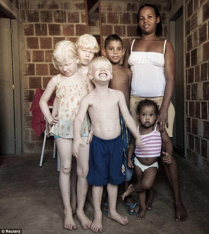 Trois albinos dans la même famille