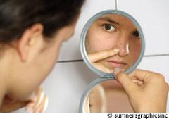 Soigner l'acné