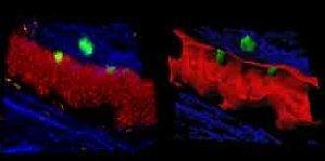 Des chercheurs ont réussi à filmer des lymphocytes T traversant la barrière méningée du cerveau. Ils sont responsables de certaines pathologie auto-immunes comme la sclérose en plaques.