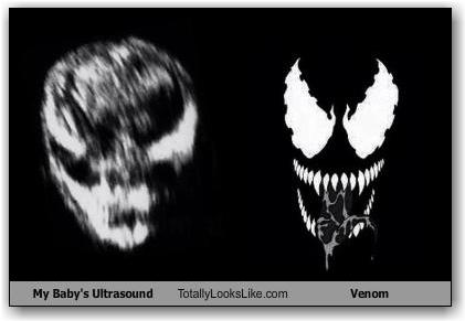 my-babys-ultrasound-totally-looks-like-venom