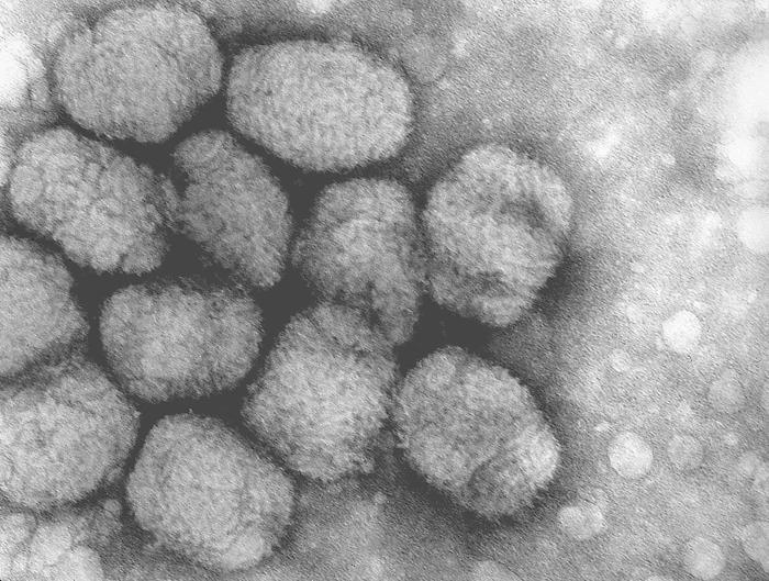 Fichier:Smallpox virus.jpg