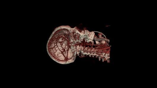 UNE TOMO POUR DES AUTOPS DE LUXE ...