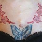 thumbs la scarification 010 La scarification (42 photos)