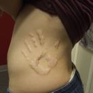 thumbs la scarification 036 La scarification (42 photos)