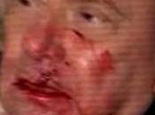 Vidéo Silvio Berlusconi frappé visage