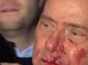 Vidéo: Berlusconi prend statuette dans gueule