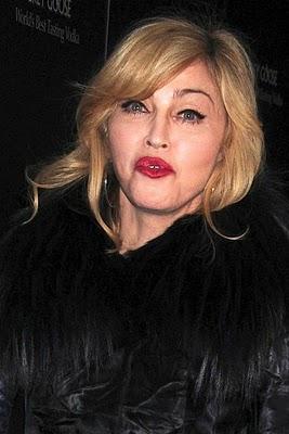 Madonna a vraiment abusé de la chirurgie !