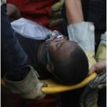 haitien-150x150 Haïti: Un miraculé après 11 jours!
