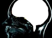 Osti tête enflé Mickael Vendetta!