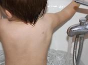 Première morsure d'amuuuur