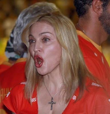 Madonna : son lifting a craqué !