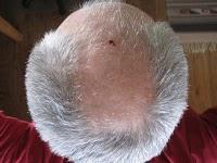 Mettre un casque ou pas pour skier?