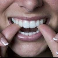 Image-employeur et dents blanches