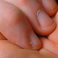 Soigner les Petites  peaux autour des ongles
