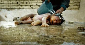 http://www.arabamericannews.com/news/images/articles/2008_06/1202/u1_Iraq_Deformed_Children_3.gif