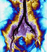 Comment le cerveau humain mémorise-t-il un son ?