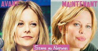 chirurgie esthetique