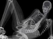 Calendrier pin-up x-ray