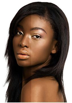 Comment traiter l'acné pour la peau noire