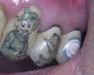 tattoos-dents-15