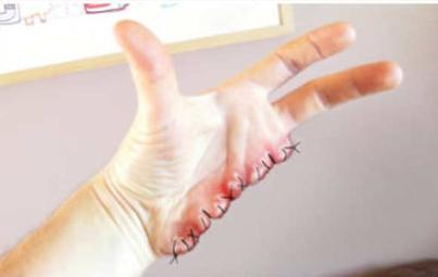 Iphone 4 : Faut il vous l'envelopper ?