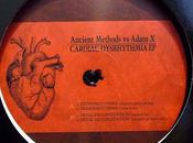 Ancient Methods Adam Cardiac Dysrhythmia Sonic Groove 2010