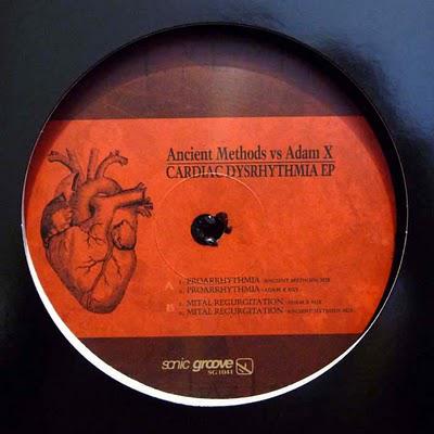 Ancient Methods vs Adam X - Cardiac Dysrhythmia EP [ Sonic Groove ] 2010