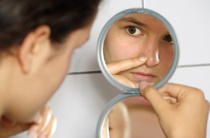 quelles sont les causes symptomes d'acne bouton