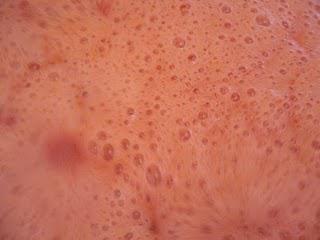 Accouchements confiturés.