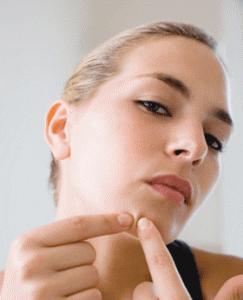 Problèmes d’acné : 6 erreurs à ne pas commettre !