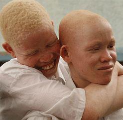 Cancer de la peau : La hantise des albinos 