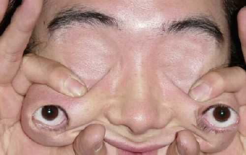 Bienvenue dans le monde des zinzins...