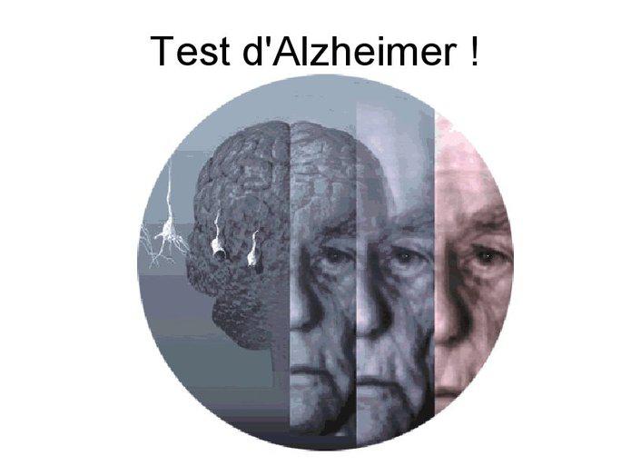 Test d'Alzheimer
