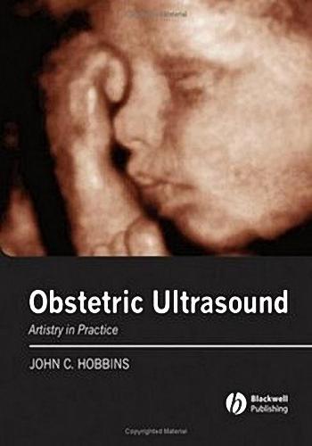 Radiology Imaging : Ultrasound