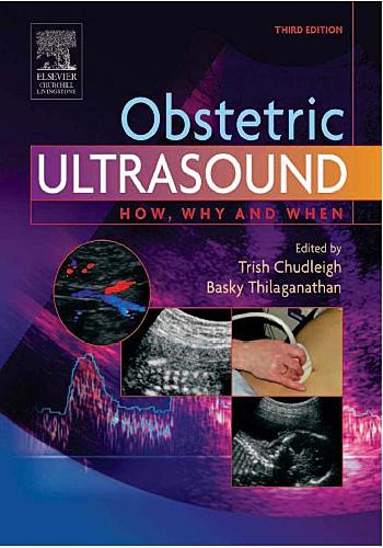 Radiology Imaging : Ultrasound