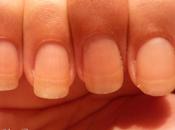 Ongles naturel Part