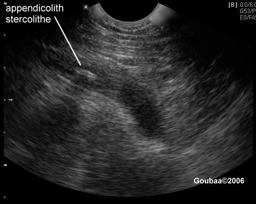 SANTE : repartie, revenue !
