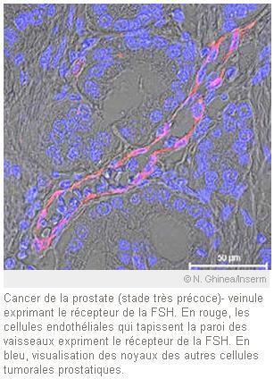 MEDECINE: Découverte d'un marqueur biologique impliqué dans 11 sortes de cancers