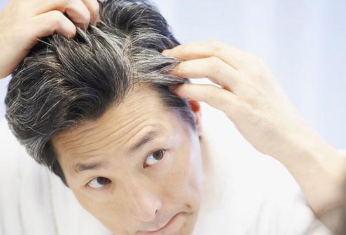 quelles sont les causes des cheveux blancs gris?
