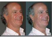 Corrections automatiques, faciles rapides photos