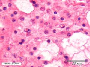 Quand les huitres se meurent…