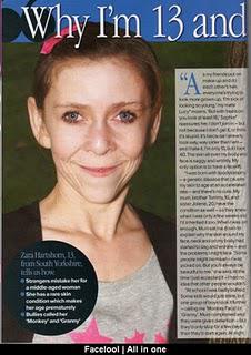 [Video] Une fille de 13 ans ressemble à une vieille femme !