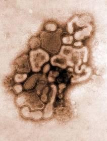 virus-grippe-h1n1.1294031529.jpg