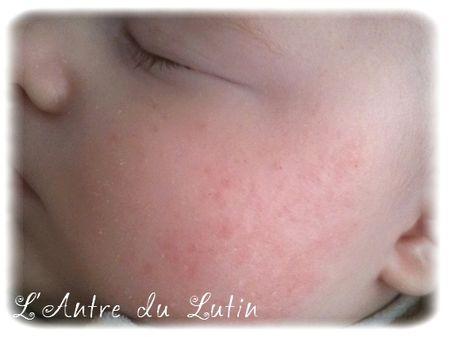 Soins Anti Eczema Pour Bebe Lutin Paperblog