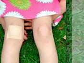 Genou cailloux clous