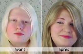 Angel Stillman Avant et Après modifié son apparence pour camoufler son albinisme