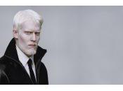 Faire lumière beauté albinos