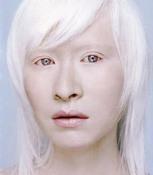 Faire la lumière sur la beauté et les albinos