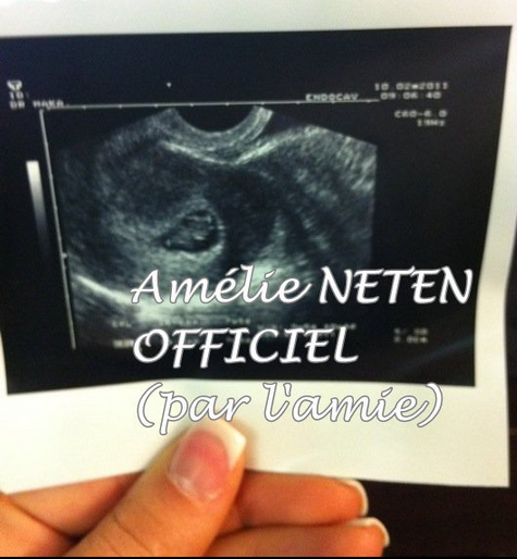 Amélie aurait avorté, pourtant elle publie une échographie datée....
